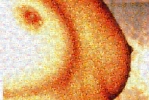 Busen-Mosaic